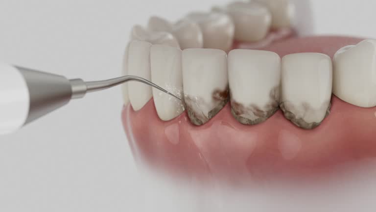 Reliable Emergency Dentist contractor in Mentone, IN by Smile Center Dentistry